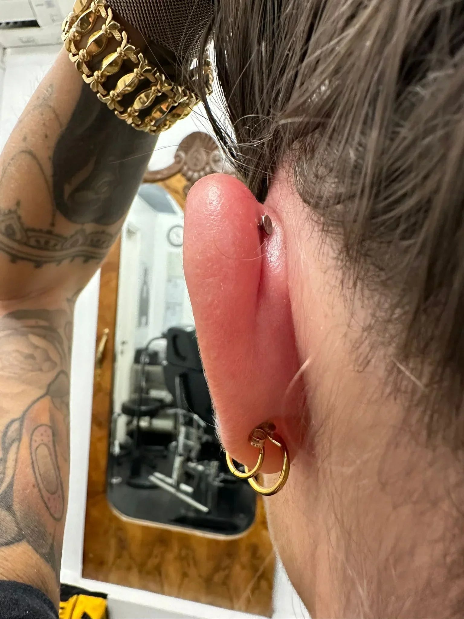 Piercing infetto o irritato